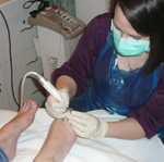 debriding the toe nail