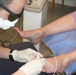 laser nail treatment