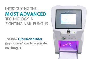 Introducing the most advanced technology in fighting nail fungus. The new Lunula cold laser, the ‘no pain’ way to eradicate nail fungus.
